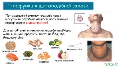 Гіпофункція щитоподібної залози