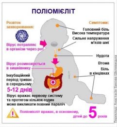 ПОЛІОМІЄЛІТ