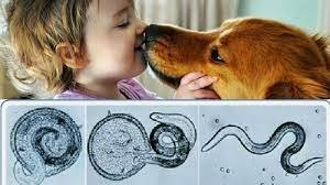 Що таке трихінельоз?