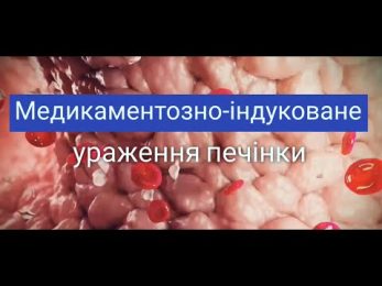Медикаментозно-індуковане ураження печінки (DILI)