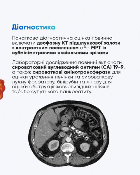 Рак підшлункової залози