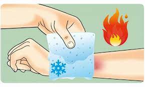 Що робити у разі опіків має знати кожен