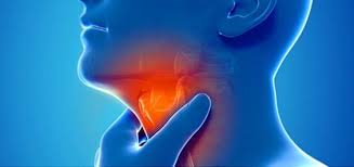 Ангіна або гострий тонзиліт