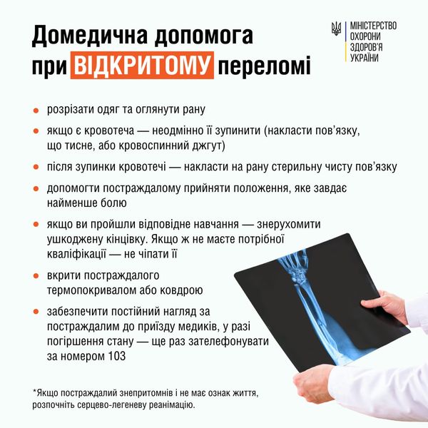 Розповідаємо базову інформацію про те, що робити у разі перелому, та які вони бувають