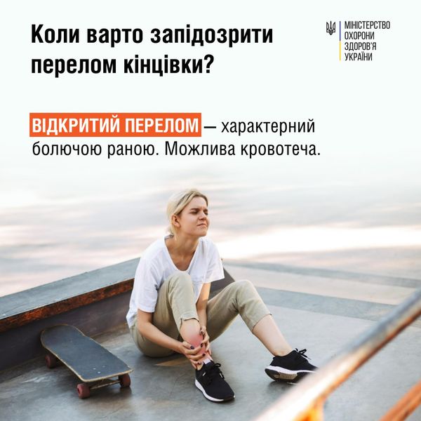 Розповідаємо базову інформацію про те, що робити у разі перелому, та які вони бувають