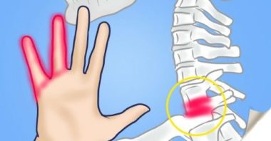 Якщо у вас терпнуть руки — негайно до лікаря!