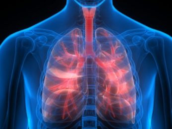 Тромбоемболія легеневої артерії