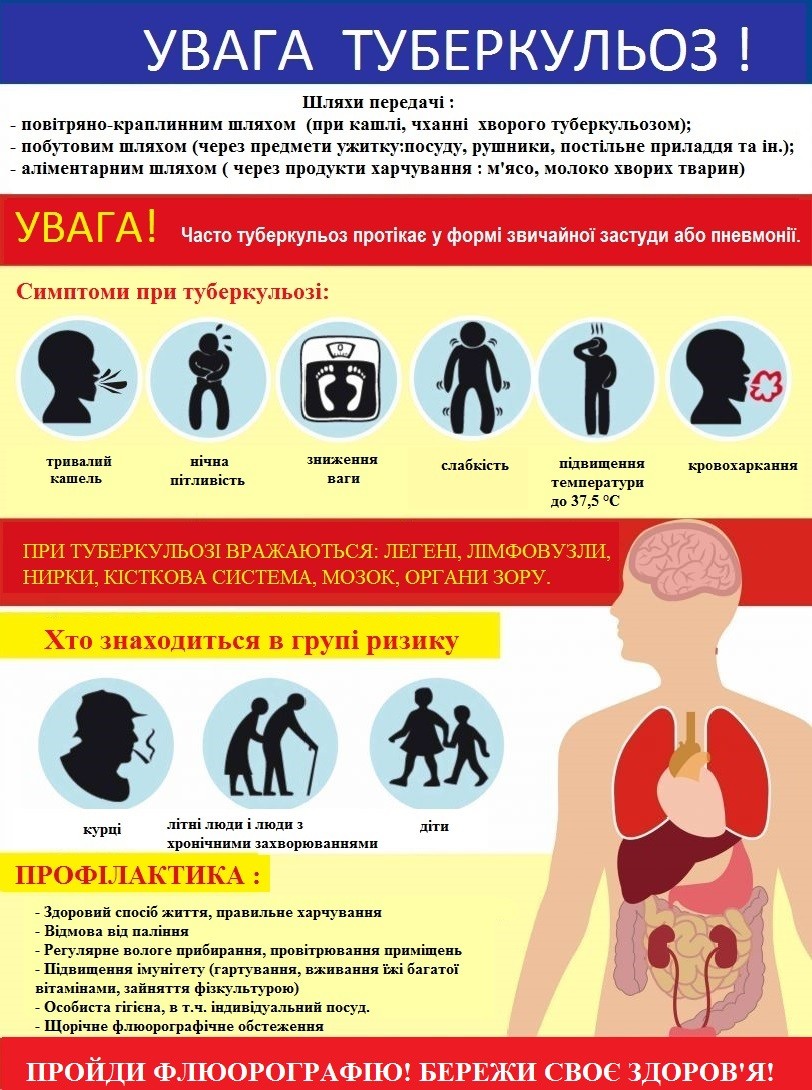 Туберкульоз