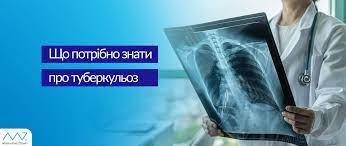 Туберкульоз