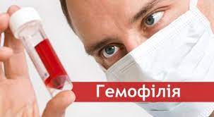 Що треба знати про гемофілію: міфи і правда