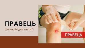 Що таке правець?