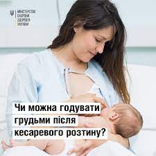Незалежно від того, як ви народжуватимете дитину, ви можете годувати грудьми
