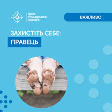 У День ходіння босоніж наголосимо на профілактиці правця