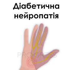 Діабетична нейропатія