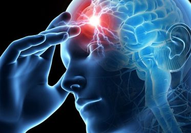 Транзиторна ішемічна атака