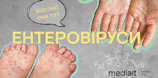 Ентеровіруси