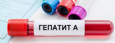 Гепатит А
