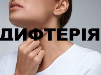 Дифтерія
