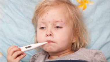 Вітрянка у дорослих: чому це небезпечно та чи можна захворіти знову?