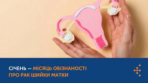 Січень — місяць обізнаності про рак шийки матки