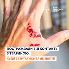 Куди можна звернутись по допомогу у разі укусів, подряпин, ослинень тваринами?