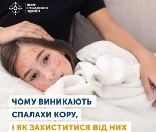 Спалахи кору виникають періодично — раз на 5-6 років через низку причин