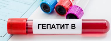 Гепатит В