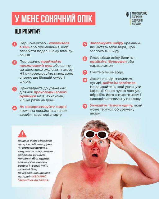 У мене сонячний опік. Що робити?