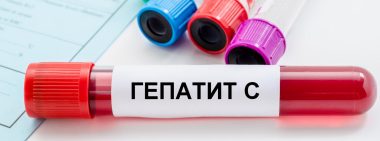 У чому небезпека вірусу гепатиту С?