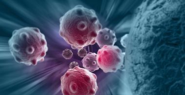 РАК КРОВІ: ВАЖЛИВЕ ПРО ХВОРОБУ, ЯКУ МОЖНА ПЕРЕМОГТИ