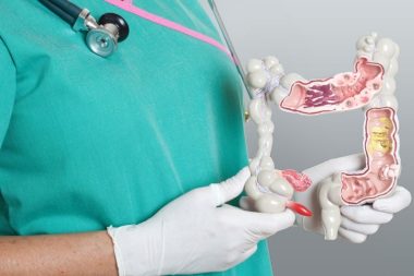 Колоноскопія