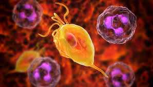 Трихомоніаз