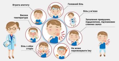 Епідпаротит