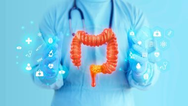 Колоректальний рак