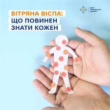 В Україні щороку реєструють понад 50 000 випадків вітряної віспи