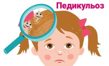 Лікування педикульозу у дитини